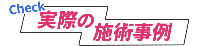 実際の施術事例